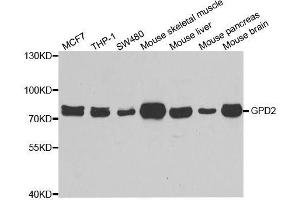 Western blot analysis of extracts of various cell lines, using GPD2 antibody. (GPD2 抗体  (AA 25-325))