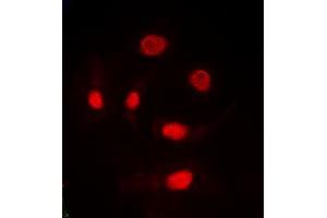 Immunofluorescent analysis of TRA2A staining in HeLa cells. (TRA2A 抗体  (C-Term))