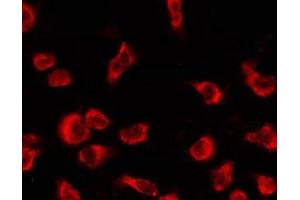Immunofluorescence (fixed cells) (IF/ICC) image for anti-Olfactory Receptor, Family 4, Subfamily C, Member 12 (OR4C12) (Internal Region) antibody (ABIN6263861)