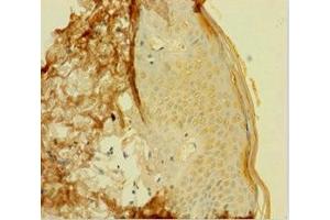 Immunohistochemistry of paraffin-embedded human skin tissue using ABIN7154376 at dilution of 1:100