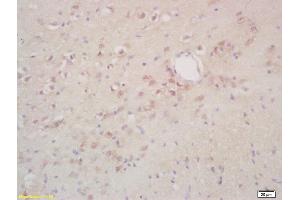 Formalin-fixed and paraffin embedded rat brain labeled with Rabbit Anti phospho-NIFK/MKI67IP(Thr234) Polyclonal Antibody, Unconjugated (ABIN872293) at 1:200 followed by conjugation to the secondary antibody and DAB staining (NIFK 抗体  (pThr234))