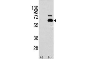 Western blot analysis of p70 S6 Kinase antibody and 293 cell lysate (2 ug/lane) either nontransfected (Lane 1) or transiently transfected with the RPS6KB1 gene (2).