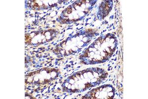 Immunohistochemistry of paraffin-embedded Human colon using FGF2 Rabbit pAb (ABIN3020744, ABIN3020745, ABIN3020746 and ABIN6213702) at dilution of 1:100 (40x lens). (FGF2 抗体  (AA 143-288))