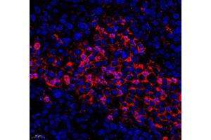 Immunofluorescence of paraffin embedded human ovarian cancer using KCTD19 (ABIN7075147) at dilution of 1: 500 (400x lens) (KCTD19 抗体)