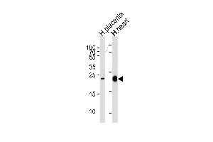 Western blot analysis of lysates from human placenta and heart tissue lysates (from left to right), using FRAT2 Antibody at 1:1000 at each lane.