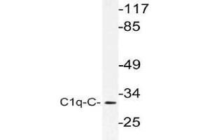 Western blot (WB) analysis of C1q-C antibody in extracts from rat lung cells. (C1QC 抗体)