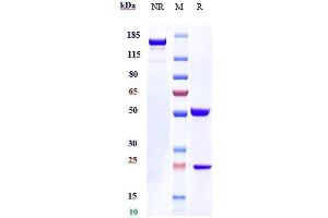 Anti-IL-31Ra Reference Antibody (nemolizumab) on SDS-PAGE under reducing (R) condition.