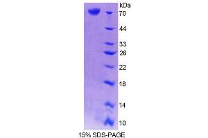 SDS-PAGE analysis of Mouse CRTAP Protein. (CRTAP 蛋白)