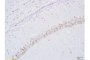 Formalin-fixed and paraffin embedded rat brain tissue labeled with Anti-BrdU(A7) Monoclonal Antibody, FITC Conjugated (bsm-0917M-FITC) at 1:200 for 40 minutes at 37°C followed by labeling Rabbit Anti-Tubulin Beta, Cy3 conjugated-Cy3) 1:200, 40 minutes at 37°C (BrdU 抗体)