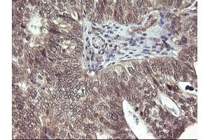 Image no. 1 for anti-Parvin, alpha (PARVA) antibody (ABIN1496442) (Parvin alpha 抗体)