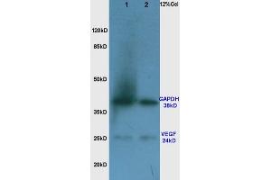 Rat lung lysates probed with Anti VEGF Polyclonal Antibody, Unconjugated (ABIN674829) at 1:200 in 4 °C.