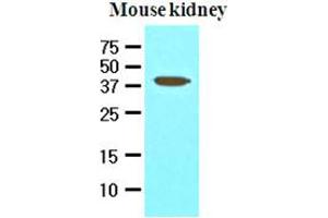 Western Blotting (WB) image for anti-Apoptosis, Caspase Activation Inhibitor (AVEN) (AA 254-362) antibody (ABIN336089) (AVEN 抗体  (AA 254-362))