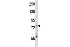 Syk antibody western blot analysis in MDA-MB453 lysate. (SYK 抗体  (AA 195-223))