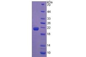 SDS-PAGE analysis of Human Calreticulin Protein. (Calreticulin Protein (CALR))