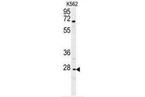 CXCR3 Antibody (Center) western blot analysis in K562 cell line lysates (35µg/lane). (CXCR3 抗体  (Middle Region))