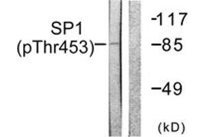 Western blot analysis of extracts from A549 cells, using SP1 (Phospho-Thr453) Antibody. (SP1 抗体  (pThr453))