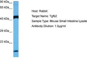 Host: Rabbit Target Name: TGFB2 Sample Tissue: Mouse Small Intestine Antibody Dilution: 1ug/ml (TGFB2 抗体  (Middle Region))