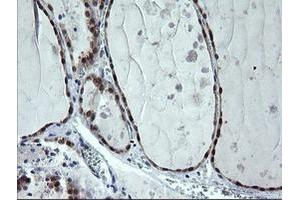 Image no. 2 for anti-Cytidine Monophosphate (UMP-CMP) Kinase 1, Cytosolic (CMPK1) antibody (ABIN1497542) (Cytidine Monophosphate (UMP-CMP) Kinase 1, Cytosolic (CMPK1) 抗体)