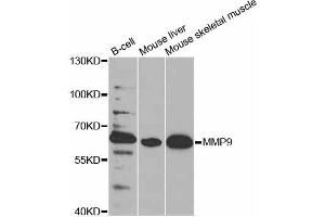 Western blot analysis of extracts of various cell lines, using MMP9 antibody. (MMP 9 抗体)
