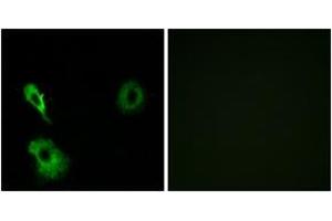 Immunofluorescence analysis of A549 cells, using GRM7 Antibody. (GRM7 抗体  (AA 351-400))