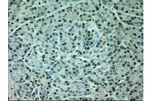 Immunohistochemical staining of paraffin-embedded Kidney tissue using anti-NEUROG1mouse monoclonal antibody. (Neurogenin 1 抗体)