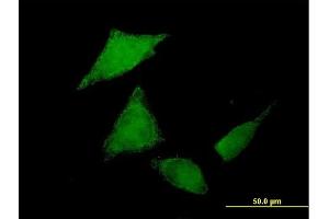 Immunofluorescence of purified MaxPab antibody to C9orf96 on HeLa cell. (C9orf96 抗体  (AA 1-680))