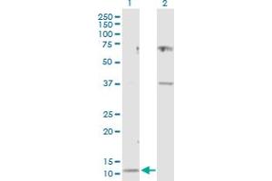 Western Blot analysis of CST3 expression in transfected 293T cell line by CST3 MaxPab polyclonal antibody. (CST3 抗体  (AA 1-146))