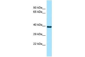 WB Suggested Anti-RSPH9 Antibody Titration: 1. (RSPH9 抗体  (N-Term))