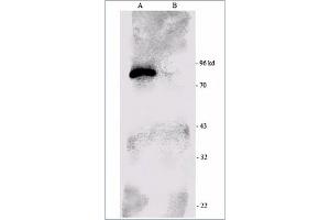 Image no. 1 for anti-Ribosomal Protein S6 Kinase, 90kDa, Polypeptide 1 (RPS6KA1) (C-Term) antibody (ABIN264872)