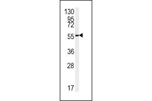 Western blot analysis of FH2 Antibody (C-term) (ABIN651343 and ABIN2840194) in HepG2 cell line lysates (35 μg/lane). (FAAH2 抗体  (C-Term))