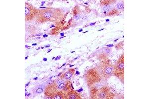 Immunohistochemistry (IHC) image for anti-Ribosomal Protein S7 (RPS7) antibody (ABIN7308296) (RPS7 抗体)