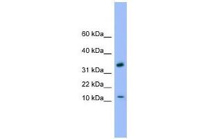GABARAP antibody used at 0. (GABARAP 抗体  (C-Term))