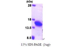 SDS-PAGE (SDS) image for Profilin 2 (PFN2) (AA 1-140) protein (His tag) (ABIN667130)