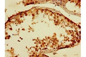 Immunohistochemistry of paraffin-embedded human testis tissue using ABIN7173606 at dilution of 1:100 (TPSB2 抗体  (AA 31-275))