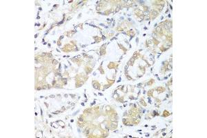 Immunohistochemistry of paraffin-embedded human stomach using RPH3AL antibody. (RPH3AL 抗体  (AA 161-315))