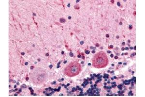 Immunohistochemical staining of human brain (Purkinje Neurons) using anti-CELSR3 antibody (CELSR3 抗体  (C-Term))
