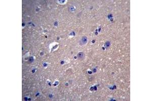 Immunohistochemistry (Paraffin-embedded Sections) (IHC (p)) image for anti-DnaJ (Hsp40) Homolog, Subfamily B, Member 6 (DNAJB6) (AA 217-247), (Middle Region) antibody (ABIN951944)