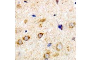 Immunohistochemical analysis of Rabphilin 3A staining in human brain formalin fixed paraffin embedded tissue section. (RPH3A 抗体)