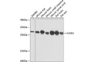 Western blot analysis of extracts of various cell lines using CALB2 Polyclonal Antibody at dilution of 1:1000. (Calretinin 抗体)