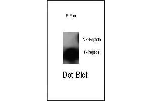 Dot blot analysis of anti-Phospho-cJun-S63 Antibody (ABIN389544 and ABIN2839589) on nitrocellulose membrane. (C-JUN 抗体  (pSer63))