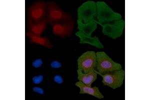 ABIN6259872 and ABIN6266829 staining Hela cells(30 min of UV treatment) by IF/ICC. (Cyclin-Dependent Kinase 15 (ALS2CR7) (Internal Region) 抗体)