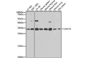 Western blot analysis of extracts of various cell lines, using CLEC7A antibody.