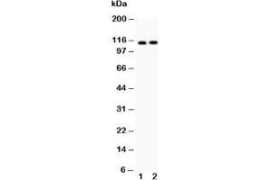 Western blot testing of ATP2A2 antibody and Lane 1:  rat skeletal muscle;  2: mouse skeletal muscle;  Predicted size: 115KD;  Observed size: 115KD (ATP2A2 抗体  (N-Term))