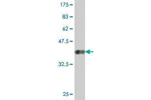 Western Blot detection against Immunogen (37.