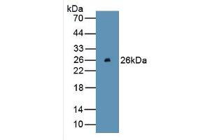 WB of Protein Standard: different control antibodies against Highly purified E. (Bcl-2 ELISA 试剂盒)