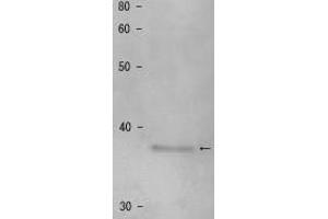 Western Blotting (WB) image for anti-Shugoshin 1 (SGOL1) antibody (ABIN2452123) (Shugoshin 抗体)