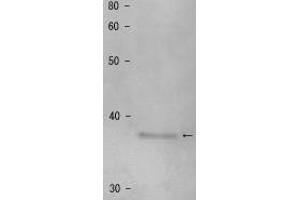 Western Blotting (WB) image for anti-Shugoshin 1 (SGOL1) antibody (ABIN2452123)