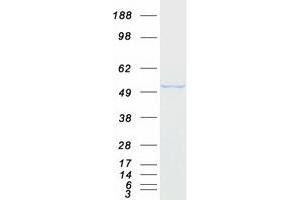 Western Blotting (WB) image for Annexin A7 (ANXA7) (Transcript Variant 1) protein (Myc-DYKDDDDK Tag) (ABIN2714746)