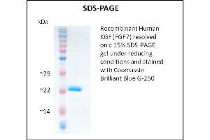 SDS-PAGE (SDS) image for Fibroblast Growth Factor 7 (FGF7) (Active) protein (ABIN5509361) (FGF7 蛋白)