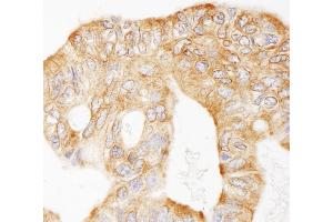 Immunohistochemistry (IHC) image for anti-Microtubule-Associated Protein 4 (MAP4) (AA 1102-1152) antibody (ABIN7453725)